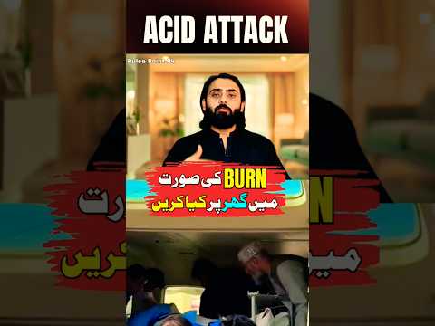 #burn #burnoutrecovery #treatment #healthnews #medicalawareness #pulsepointpk #drnabighach