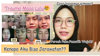 Kenapa Aku Bisa Jerawatan & Cara Aku Lepas Dari Jerawat (PART 2)