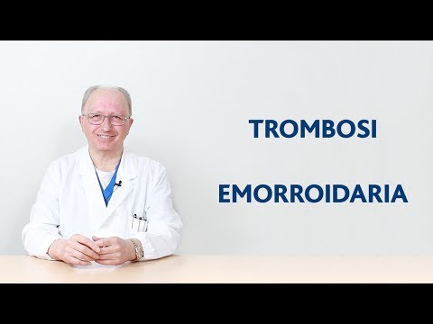 Video: Trombosi Emorroidaria: Trattamento, Rimozione, Aspetto, Recensioni