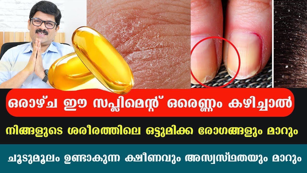 ഒരാഴ്ച ഈ സപ്ലിമെന്റ് ഒരെണ്ണം കഴിച്ചാൽ നിങ്ങളുടെ ശരീരത്തിലെ ഒട്ടുമിക്ക രോഗങ്ങളും മാറും / Dr Shimji