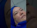Др. Шахзода Сулейманова +998 90 027 77 76 #blefaroplastika #plasticsurgeon