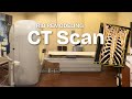 CT Scan for Rib Remodeling: What you need to know