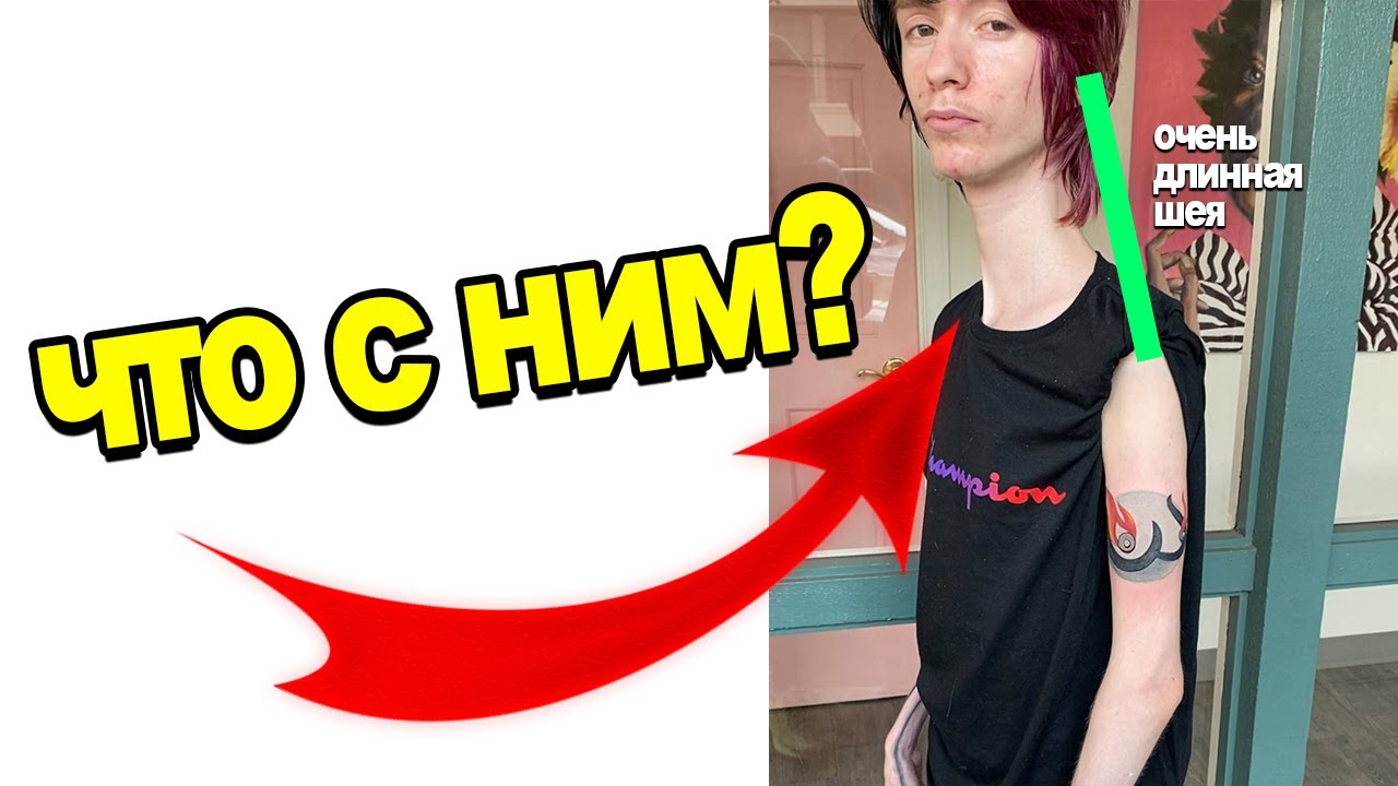 🔴 DADDY LONG NECK ЧТО С НИМ? КТО ЭТО?