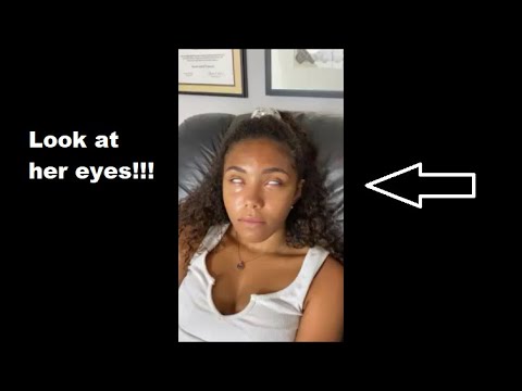 Eyeroll Hypno