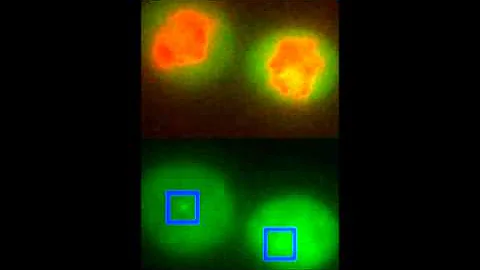 Narrated: RNA Being Made by a Gene - DayDayNews
