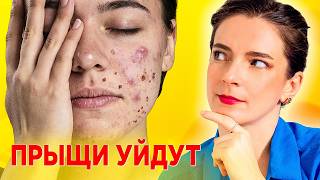 видео: ПРЫЩИ? КОЖА САМА НАЧНЕТ ВОССТАНАВЛИВАТЬСЯ! Узнайте, что нужно для ЗДОРОВОЙ и ЧИСТОЙ КОЖИ! картинка: ПРЫЩИ? КОЖА САМА НАЧНЕТ ВОССТАНАВЛИВАТЬСЯ! Узнайте, что нужно для ЗДОРОВОЙ и ЧИСТОЙ КОЖИ!