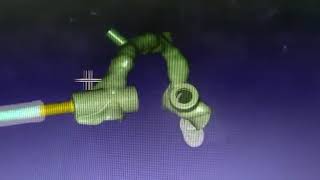 Exoplan Guide for Zygomatic implants