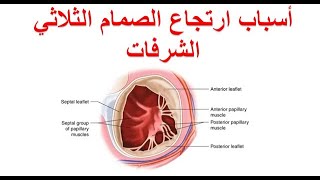 ما هي أسباب ارتجاع الصمام الثلاثي الشرفات ؟ ١٠ أسباب لقصور الصمام الثلاثي الشرفات