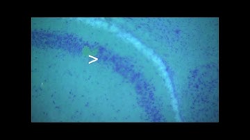 Microdissection of Mouse Brain Tissue using KuiqpicK