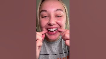 How should a night guard fit