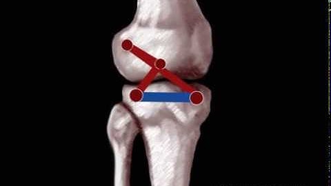 Four-Bar Mechanism of the Knee