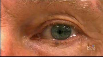 Toronto Memory Program’s Retinal Scan for Alzheimer’s Featured on CTV News