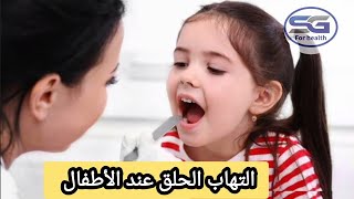 التهاب الحلق عند الاطفال في فصل الشتاء أساببه وعلاجه !!