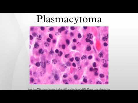 Video: Unicentrisk Blandet Variant Castleman Sygdom Forbundet Med Intrabronchial Plasmacytoma