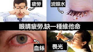 眼睛疲勞,最缺一種維生素,柏格醫生 Dr Berg