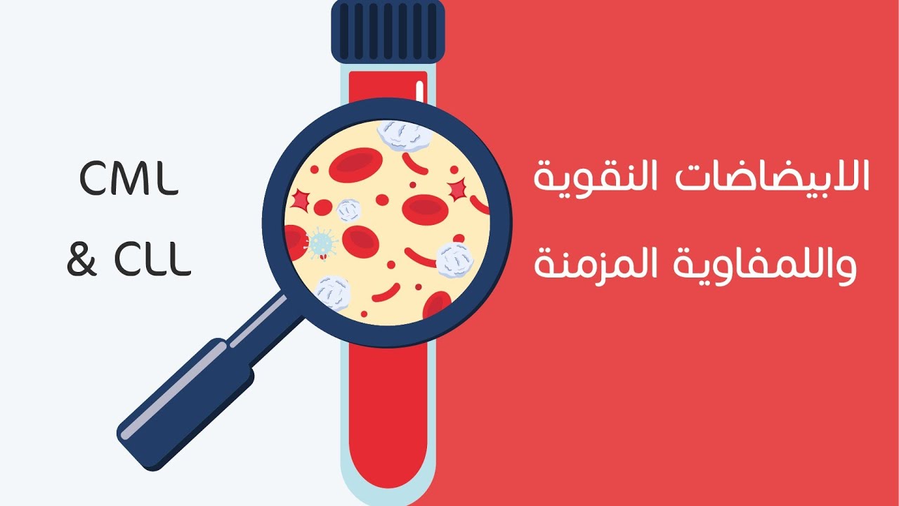 الابيضاضات النقوية واللمفاوية المزمنة