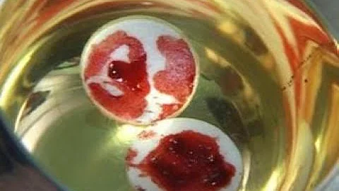 The Eucharistic Miracle of Buenos Aires