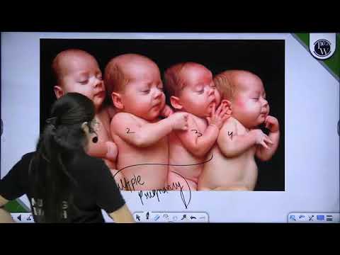 1256 Multiple Pregnancy 01 Multiple Pregnancy Reschedule 1015 A
