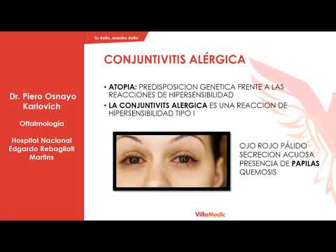 Vídeo: Conjunctivitis En Nens: Com Tractar Amb Remeis Casolans