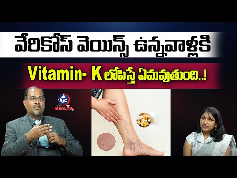 వేరికోస్ వెయిన్స్ ఉన్నవాళ్లకి..Vitamin- K లోపిస్తే ఏమవుతుంది..! | Varicose Veins | Mic Tv Health