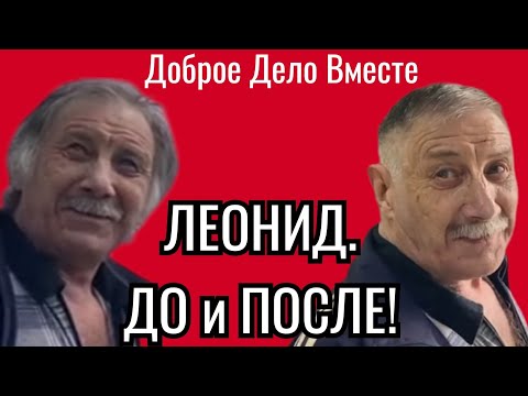 Доброе Дело Вместе. ЛЕОНИД. ❗ДО и ПОСЛЕ. ❗