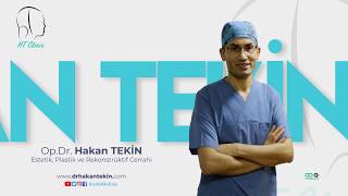 Op Dr Hakan Teki̇n - Karin Germe Abdominoplasty