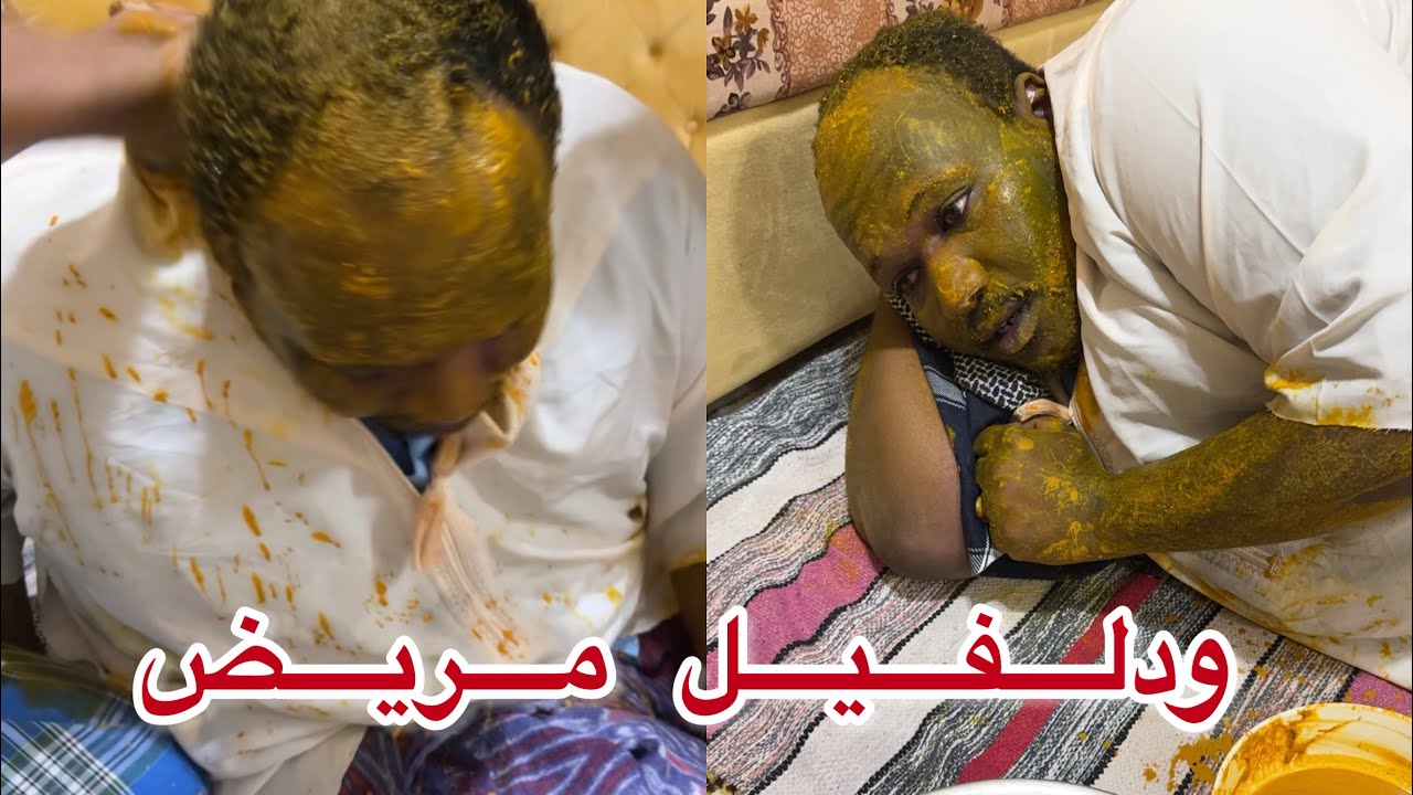 بوسيف علاج ودالفيل من العين🥺