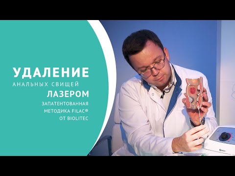 Удаление анальных свищей лазером