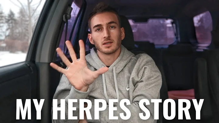 5 things i did to overcome my herpes diagnosis