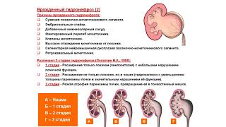 видео: УЗИ. Доктор Иогансен. Выпуск 74. Аномалии развития почек и мочеточников. Часть 6. картинка: УЗИ. Доктор Иогансен. Выпуск 74. Аномалии развития почек и мочеточников. Часть 6.