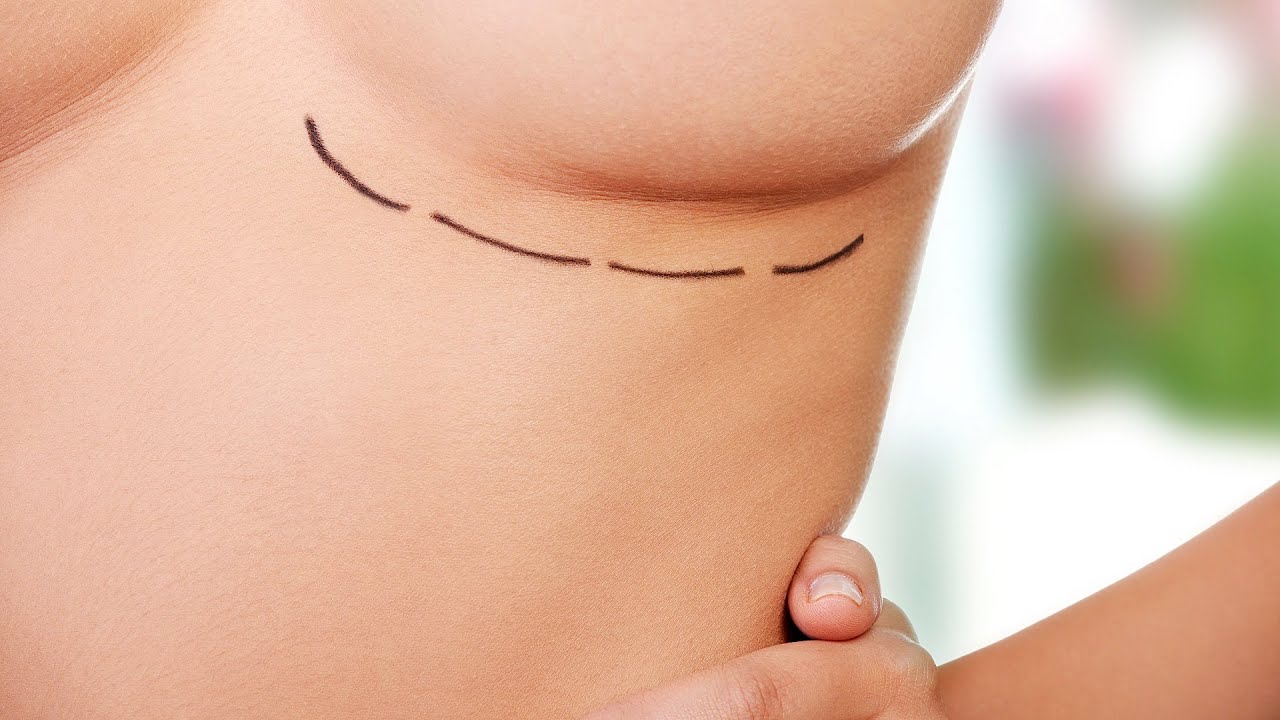 How to Pick a Breast Implant Size | Plastic Surgery