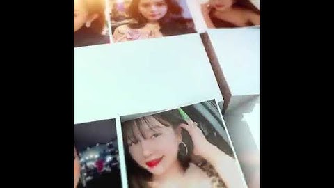 "Siêu Phẩm" Mũi Golden Line Ngày Thứ 9 Cắt Chỉ - Thẩm Mỹ Như Hoa