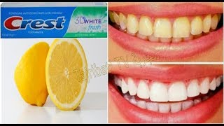 A great recipe for whitening your teeth in two minutes.️ Get white teeth like pearls  