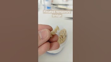 Temporary bridge #teeth #dental #dentist #dentaltechnician