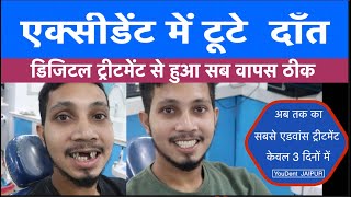 treatment of broken tooth| |smile makeover | दांत टूट जाये तो क्या करें  |best hospital for implant