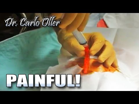 Screaming Patient's Emergency Procedure!