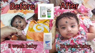 Mamaearth baby face cream Review l Sebamed baby face cream Review l Baby skincare l Best baby  cream