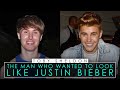 Toby Sheldon | The Man Who Wanted To Look Like Justin Bieber