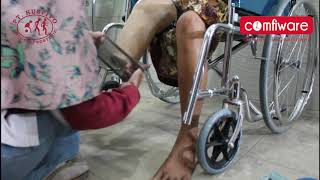Begini Cara Pemasangan Kaki Palsu Bawah Lutut  Comfiware Kaki Palsu 