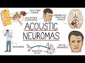 Understanding Acoustic Neuromas