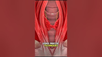 bijschildklieroperatie #bijschildklier #klieren #nek #zenuwen #weefsel #wetenschap #feiten #3dani...