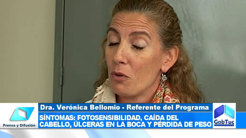 lupus eritematoso sistemico perdida de peso