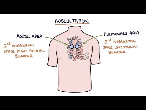 Heart Murmurs and Heart Sounds: Visual Explanation for Students