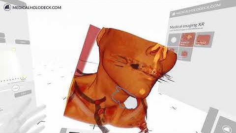 Display Dicom in Virtual Reality