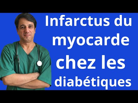 Coups silencieux de