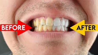 whiten teeth photoshop #tutorial #photoshop