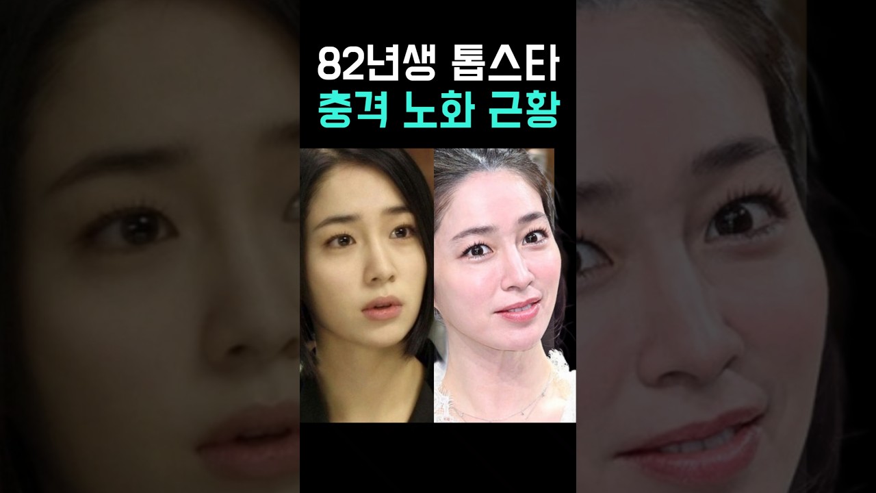 82년생 톱스타들, 충격 노화 근황