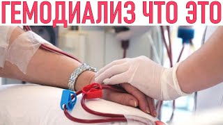 ГЕМОДИАЛИЗ | Что такое диализ и кому он нужен