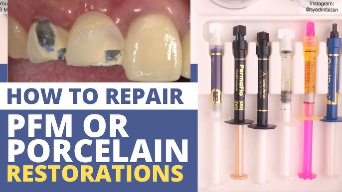 How to repair Porcelain or Ceramic crowns using Waldent Ceramic Repair Kit  