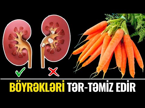 Video: Faydalılığın tərifi nədir?